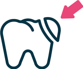 詰め物イメージイラスト