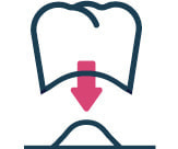 被せ物イメージイラスト