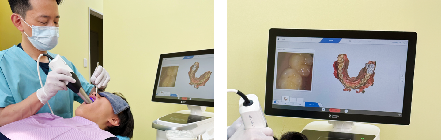 印象採得の治療風景