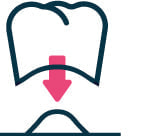 被せ物イメージイラスト