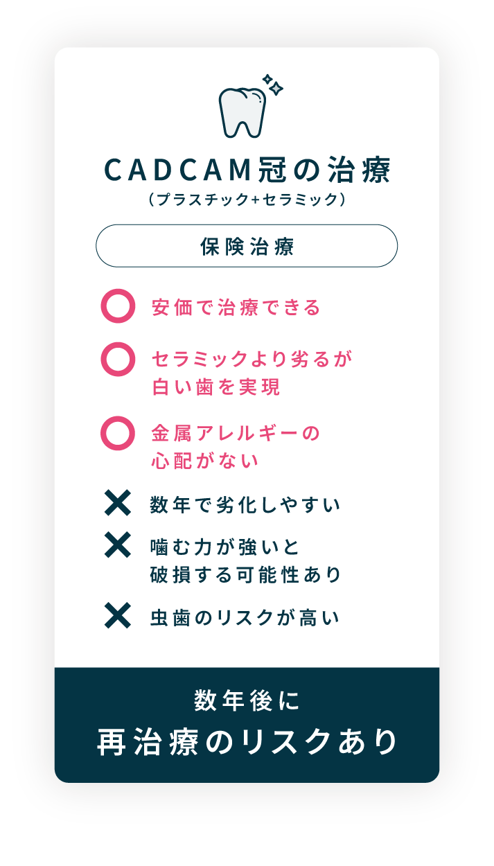 CADCAM冠のメリット・デメリット